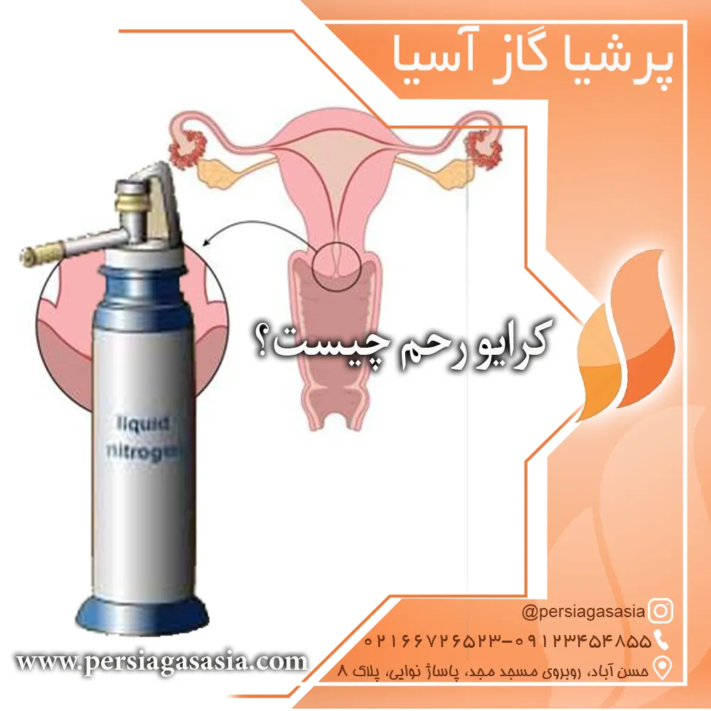 کرایو رحم چیست