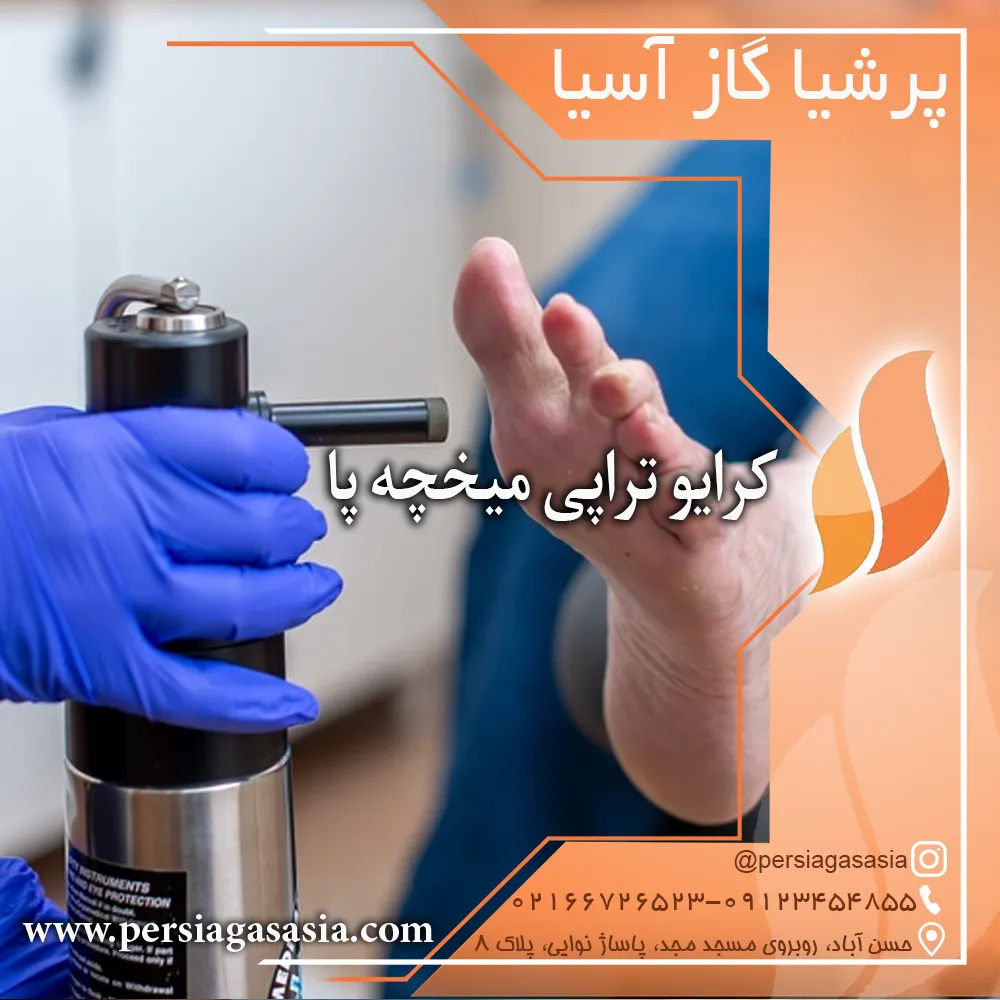 کرایوتراپی میخچه پا